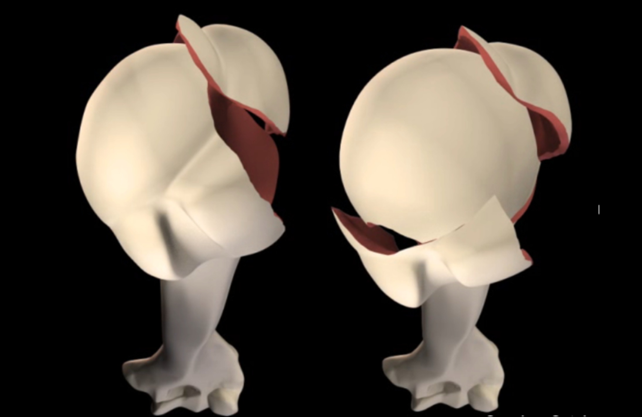 prothese-epaule-paris-ouest-16