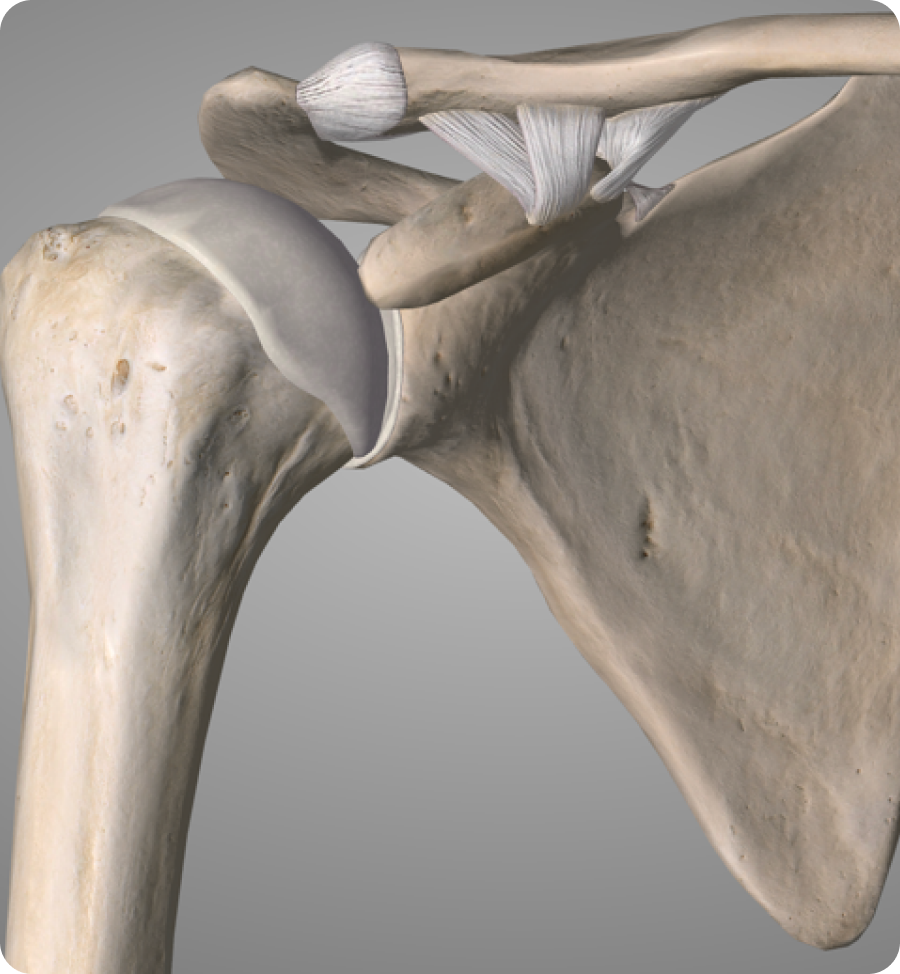 Disjonction acromio-claviculaire