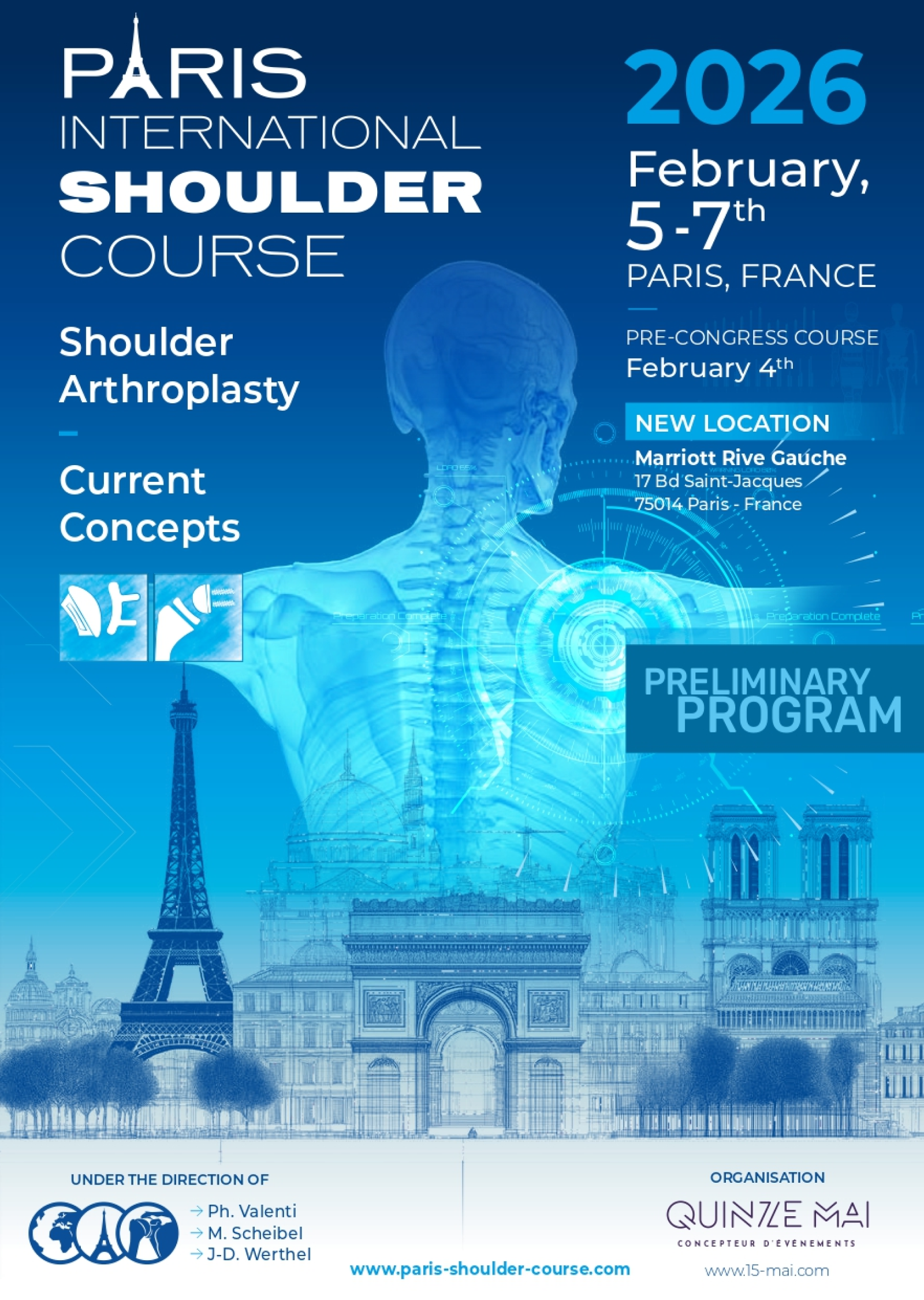 paris-shoulder