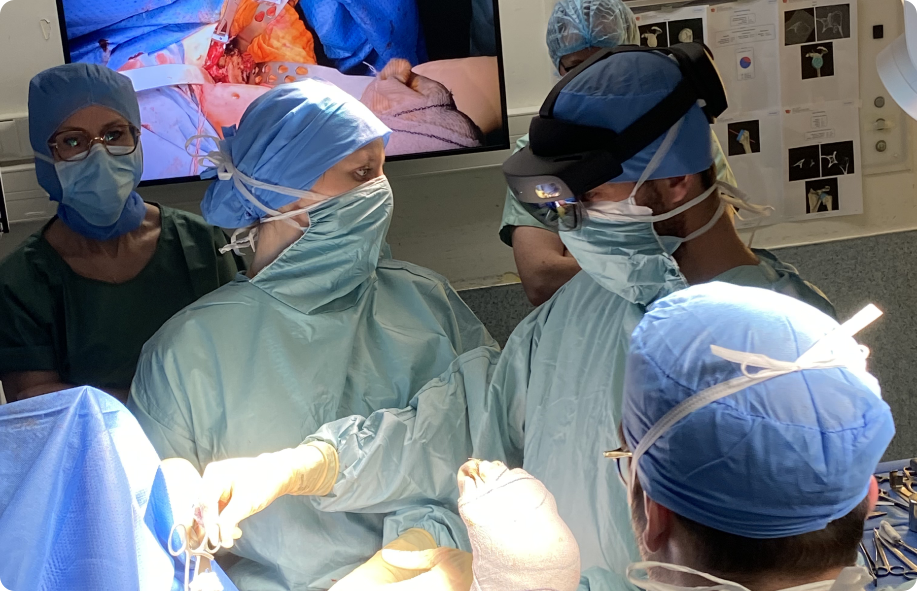 prothese-epaule-france