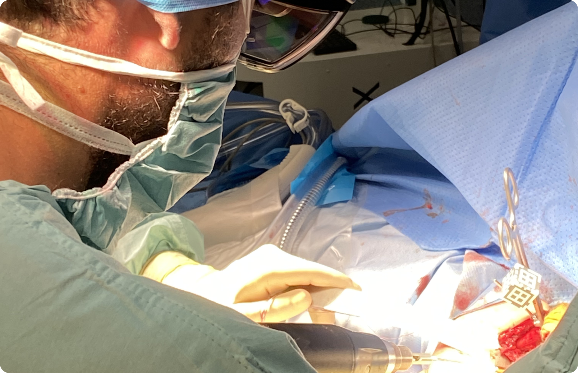 prothese-epaule-paris